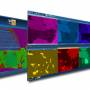 web_618_xray.jpg